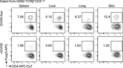 Murine Models Provide New Insights Into Pathogenesis of Chronic Graft-Versus-Host Disease in Humans